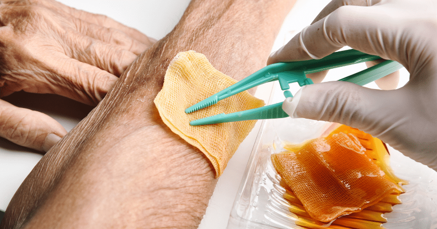 Skin Substitutes vs. Traditional Wound Care: What’s Best for Marietta, GA Patients?